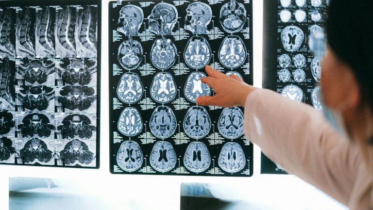 New Oxford study calls for sports-related brain injuries to be taken more seriously