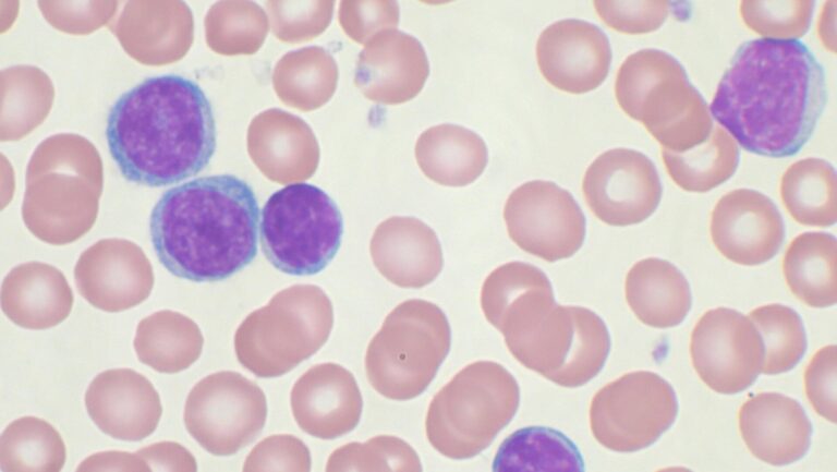 Oxford and Ohio Universities receive £9.24 million in funding for research into rare blood cancers